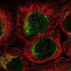 QIL1 Antibody, Novus Biologicals 25 &mu;L; Unlabeled:Antibodies, Polyclonal